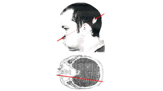 Illustration for article titled What Happens When You Stick Your Head Into a Particle Accelerator